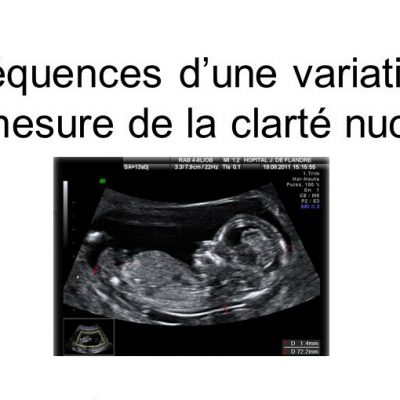 D. Subtil, Hôpital Jeanne de Flandre. D. Subtil, Hôpital Jeanne de Flandre.