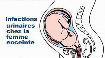 Infection urinaire chez la femme enceinte